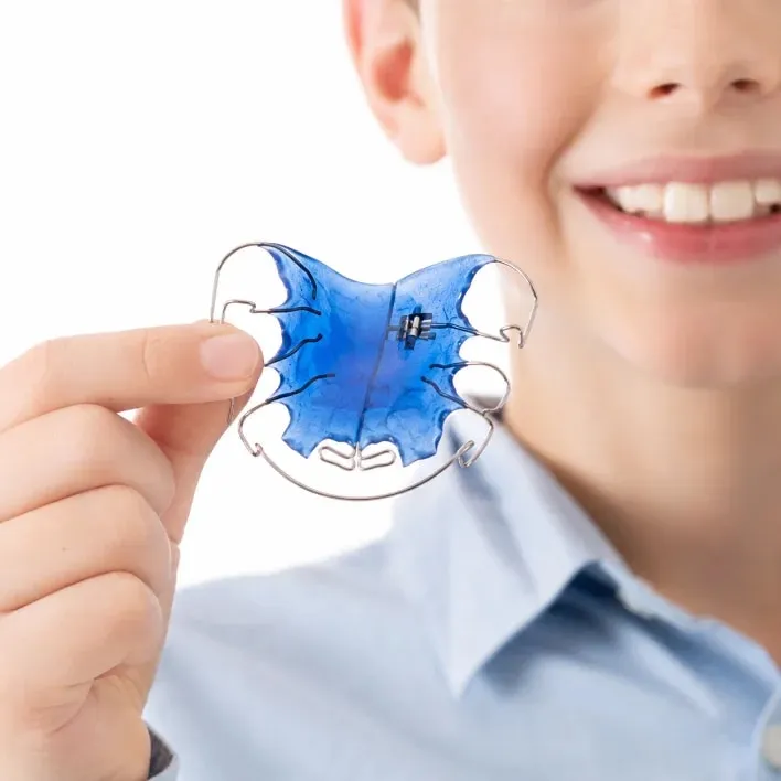 Interceptive orthodontic appliance for a child — orthodontics Luxembourg